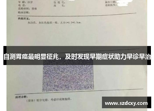 自测胃癌最明显征兆,及时发现早期症状助力早诊早治 自测胃癌最明显征兆,及时发现早期症状助力早诊早治